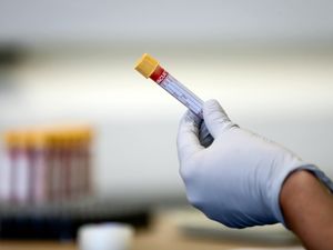 Supporting image for story: Steroids reduce risk of death in critically ill Covid-19 patients – study