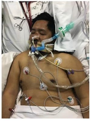 Jonathan Yague whilst he was in critical care fighting COVID.
