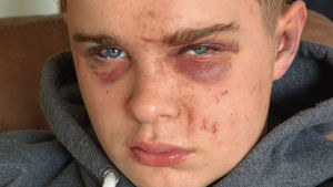 Supporting image for story