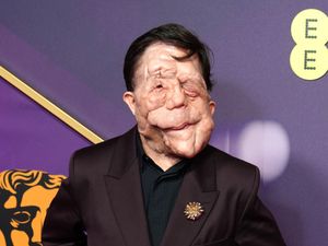 Supporting image for story: Film industry needs to stop seeing disability as a risk – A Different Man star