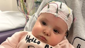 Remi has Dup15q Syndrome, a condition that causes epilepsy, autism, and severe low muscle tone. Picture: GoFundMe