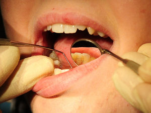 Supporting image for story: Children’s dental treatment sees sharp fall due to Covid