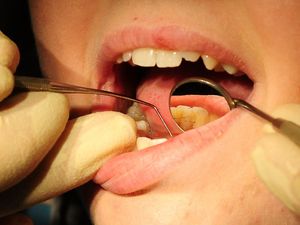 Supporting image for story: Dental tourism: 6% of adults say they have travelled abroad for care