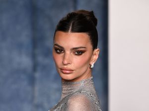 Supporting image for story: Emily Ratajkowski says she is ‘proud’ her face still moves after having Botox