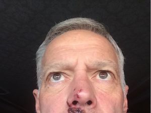 Supporting image for story: Four cyclists badly injured by pothole