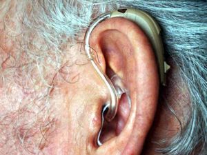 Supporting image for story: Meeting on plan to axe free hearing aids in Staffordshire