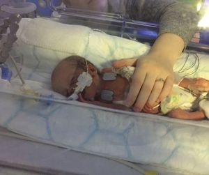 Lily-Louise Parry in the Neonatal Unit where she spent over 12 weeks. PIC: University Hospitals Birmingham NHS Foundation Trust
