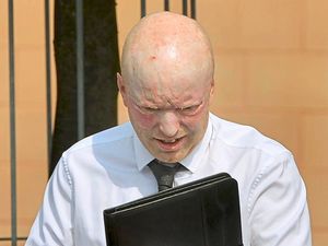 Supporting image for story: 'I tried to save victim' – Stafford factory boss tells of fireworks blaze