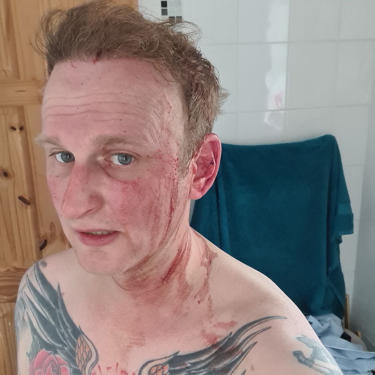 It was relentless, it wouldnt stop! - Runner left bloodied and bruised after buzzard attack in rural Shropshire