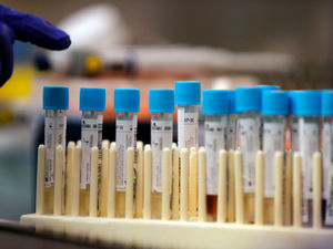 Supporting image for story: 38 workers at Wrexham food factory test positive for coronavirus