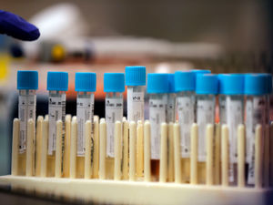 Supporting image for story: Fifth rapid testing centre opens in Wolverhampton