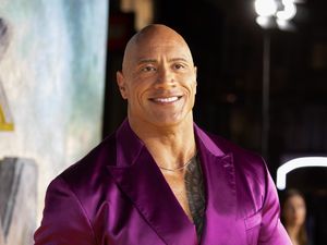 Supporting image for story: Dwayne Johnson suffers injury on set of The Smashing Machine