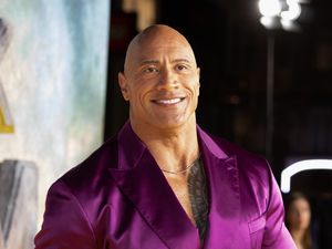 Supporting image for story: Dwayne Johnson suffers injury on set of The Smashing Machine