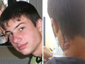 Supporting image for story: 'The next person might not be that lucky': Telford student left scarred after being stabbed by gang speaks about ordeal