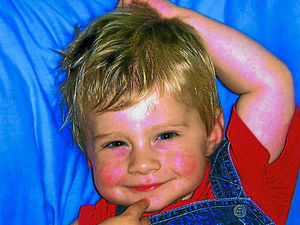 Supporting image for story: Tragic Bridgnorth family welcome Shropshire school asthma kits move