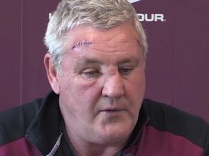 Supporting image for story: Aston Villa v Brighton: What has happened to Steve Bruce's face?