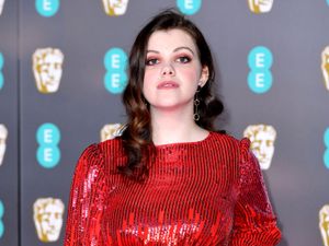 Supporting image for story: Georgie Henley reveals scars from rare infection which almost led to amputation