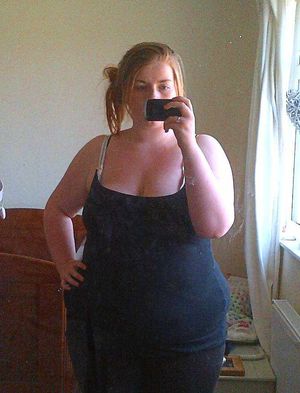 Aimee before she lost over 14 stones in weight