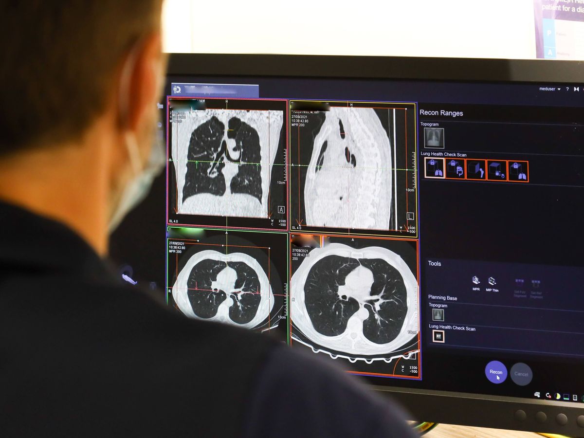 NHS trust warned of &lsquo;neglect&rsquo; after failure to spot patient&rsquo;s fatal lung cancer