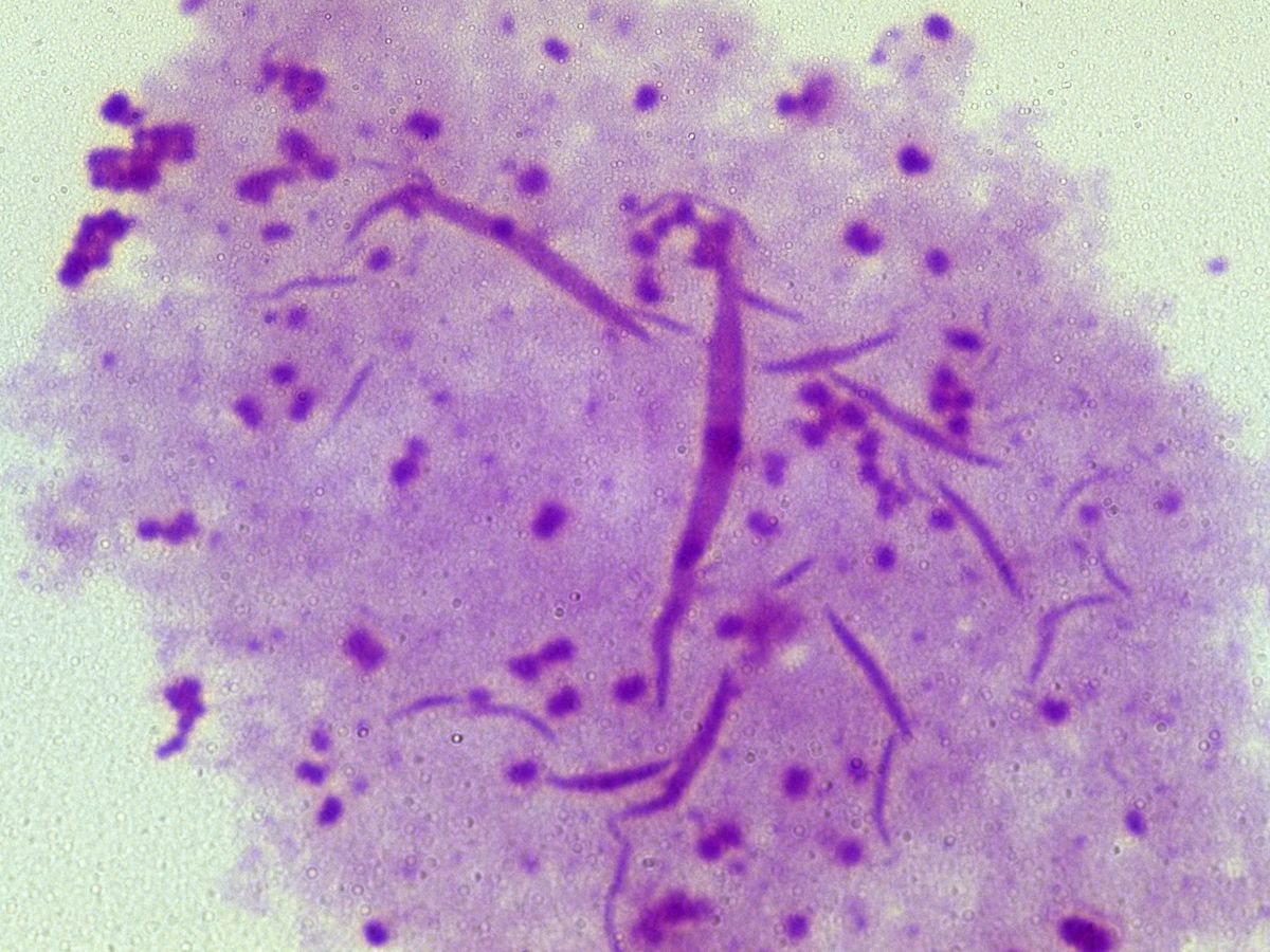 Potential new antibiotic for gonorrhoea as superbugs rise