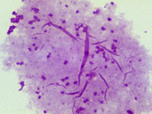Gonorrhoea bacterium under a microscope