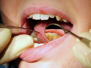 Supporting image for story: Action needed to address 'appalling' access to NHS dentistry in Shropshire