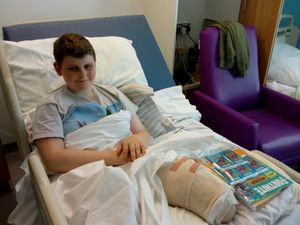 Alfie recovering from his leg amputation