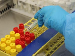 Supporting image for story: Three of 10 worst places for Covid infections in our region