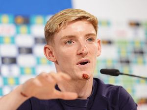 Supporting image for story: Anthony Gordon takes team-mates’ jokes on the chin after bike accident