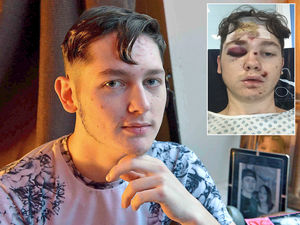 Supporting image for story: 'He's a different person': Cyclist and family speak out after 'horrific' Bilston hit-and-run