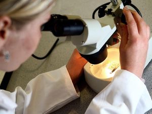 Supporting image for story: Protein shows promise in tackling breast cancer