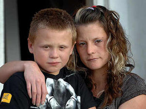 Supporting image for story: Boy suffers pitbull attack in West Bromwich park