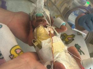 Supporting image for story: Parents praise medical staff for saving daughter born weighing just one pound