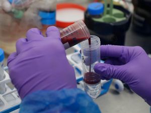 Supporting image for story: Cheap steroid dramatically reduces Covid-19 deaths – research