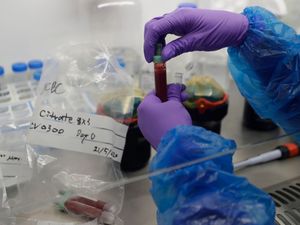 Supporting image for story: Omicron multiplies 70 times faster than Delta in airways, says Hong Kong study