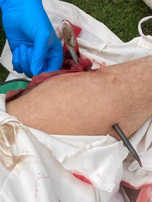 The gruesome sight of Jack's injured leg.