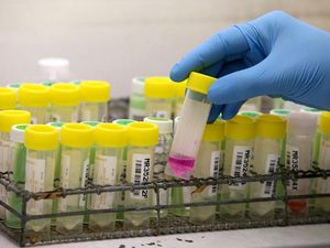 Supporting image for story: New tuberculosis test cuts diagnosis time from months to hours