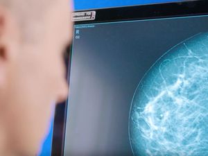Supporting image for story: Artificial intelligence set to assist breast screening in Ireland