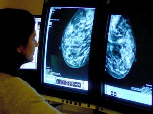 Supporting image for story: Waits for breast cancer services in Shropshire falling but 'delays will continue'