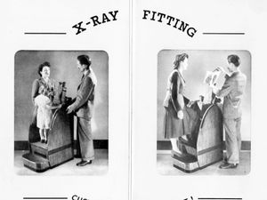 Supporting image for story: Measuring feet with a dose of radiation