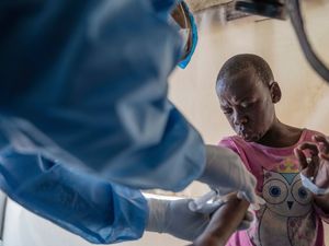 Supporting image for story: Mpox outbreaks in Africa could be halted within six months, says health chief