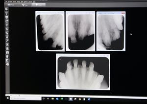 The x-ray showed Barbie's teeth to veterinary dentist experts