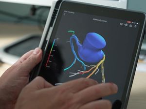 Supporting image for story: 3D heart scans have saved NHS millions since 2021 rollout, data shows