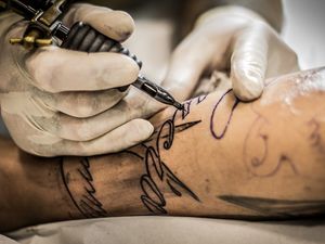 Supporting image for story: Revealed: How the number of Shropshire residents wanting rid of their tattoos has rocketed