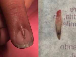 Supporting image for story