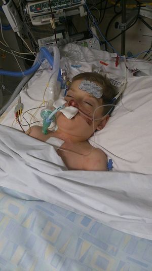 Oliver recovering from his transplant