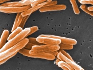 Scanning electron micrograph of tuberculosis bacteria