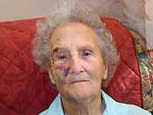 Supporting image for story: Attack victim Nancy feels 'much better'