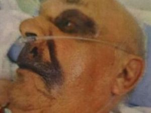 Supporting image for story: £5,000 reward to find thugs after brutal pensioner attack