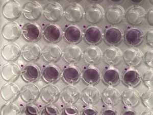 Supporting image for story: Scientists develop TB test that uses your smartphone camera